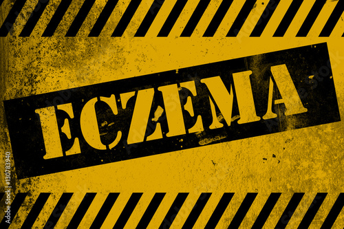 Eczema sign yellow with stripes