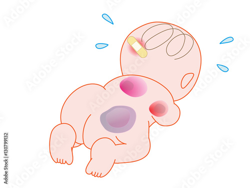暴力を受けている赤ちゃん。