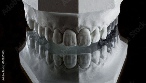 photograph of the lower jaw on a black background