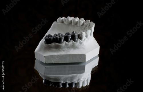 photograph of the lower jaw on a black background