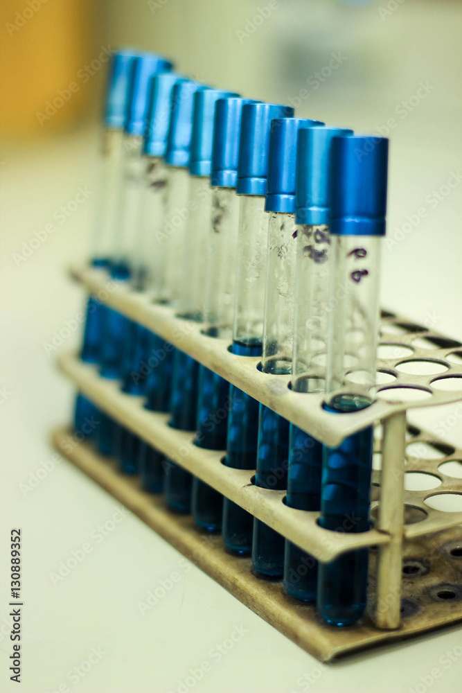 laboratory examination, laboratory testing, laboratory analysis, lab test, test tubes in racks