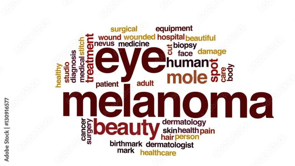 Eye melanoma animated word cloud. Eye melanoma animated word cloud.