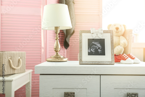 Frame with ultrasound photo...