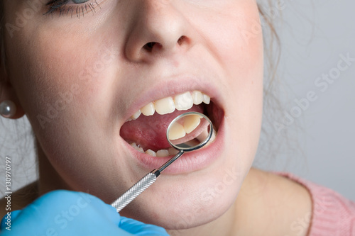 Zahnarzthand kontrolliert Mund einer jungen Frau mit dem Zahnspiegel