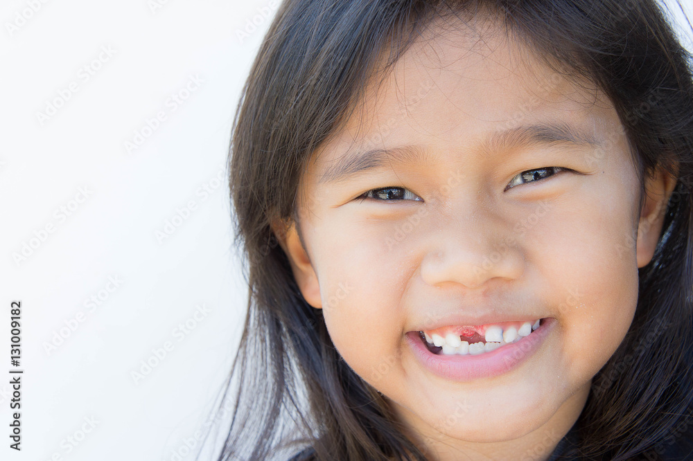 Asian girl smiling broken tooth Asian girl smiling broken tooth