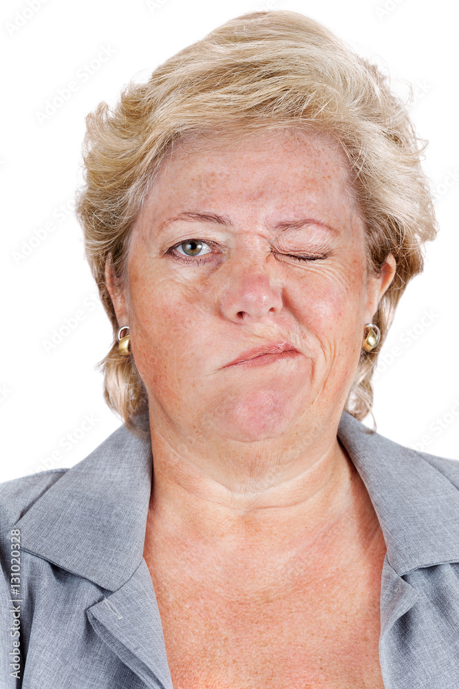 Bell's Palsy - can't scrunch up eyes