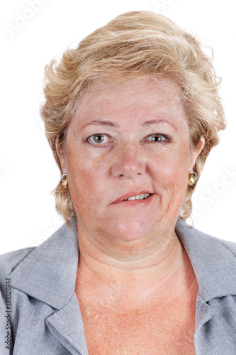 Принти на полотні Bell's Palsy - smiling