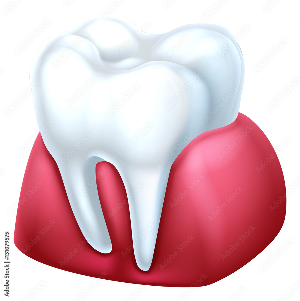 Gum and Tooth Gum and Tooth
