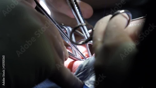 surgical teamwork,surgeon's hands