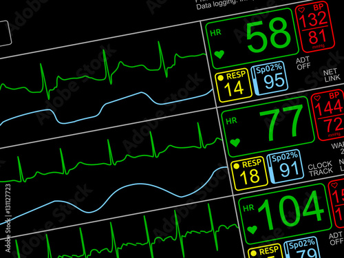 Patient's vital signs on ICU monitor, isolated closeup, dutched left