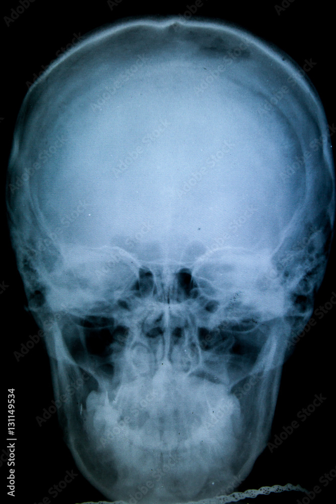 x-ray picture x-ray picture