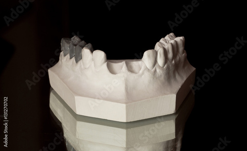 the upper jaw of plaster, photograph of the lower jaw on a black background