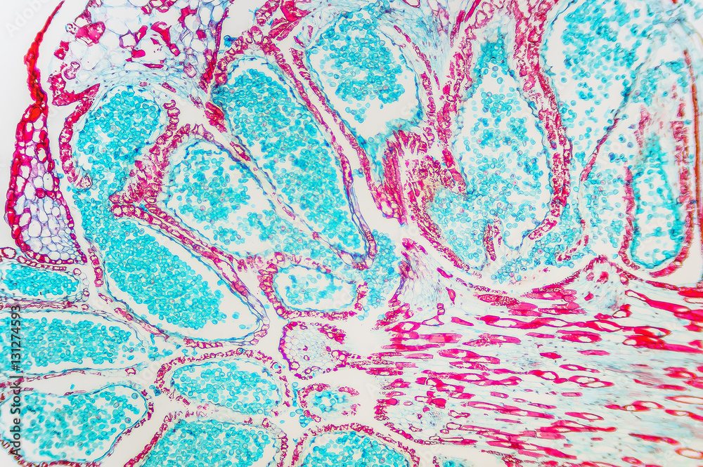 Pinus Male Strobile- cell microscopic Pinus Male Strobile- cell microscopic