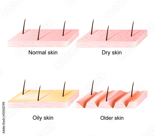 Normal, dry, oily, younger and older skin. sectional view