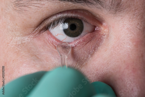 Glass eye prosthetic extraction of Ocular prosthesis