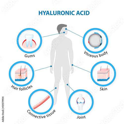 Hyaluronic Acid