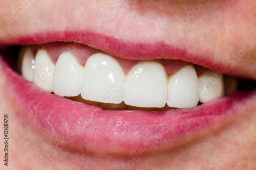 woman with shiny smile and white teeth