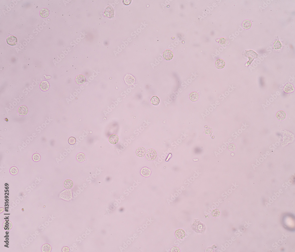 Bacteria in urine specimen under microscope 40x. Stock Photo Adobe Stock