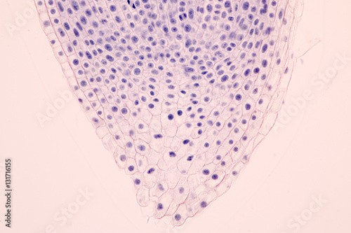 Root tip of Onion and Mitosis cell in the Root tip of Onion under a microscope. photo