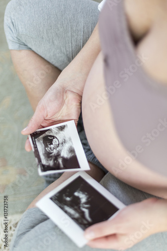 Schwangere Frau betrachtet Ultraschall-Bilder