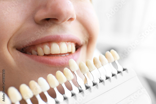 Young woman at dentist office checking and selecting colour of the teeth