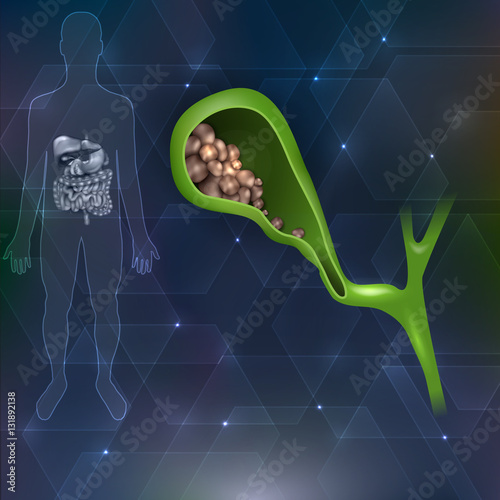 Gallstones and human silhouette with internal organs abstract hexagon background