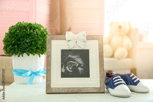 Frame with ultrasound photo...