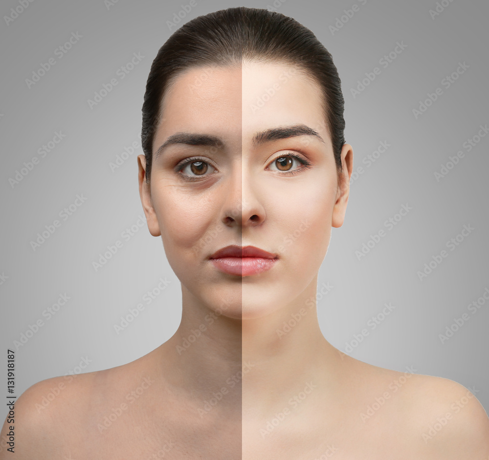 Woman face before and after cosmetic procedure. Plastic surgery concept. Woman face before and after cosmetic procedure. Plastic surgery concept.