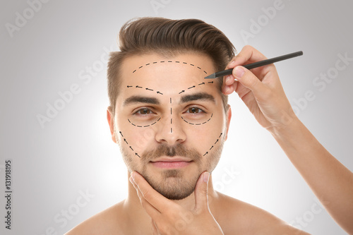 Surgeon drawing marks on ma...