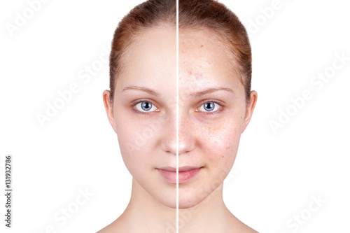 Befor and after treatment. Beautiful woman's portrait isolated on white background, before and after retouch, skin care.
