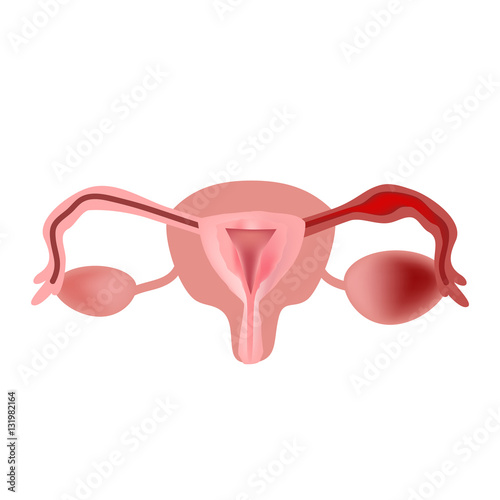 Salpingitis. Inflammation of the fallopian tube. Oophoritis.   the ovary. pelvic organs. Infographics. Vector illustration on isolated background photo