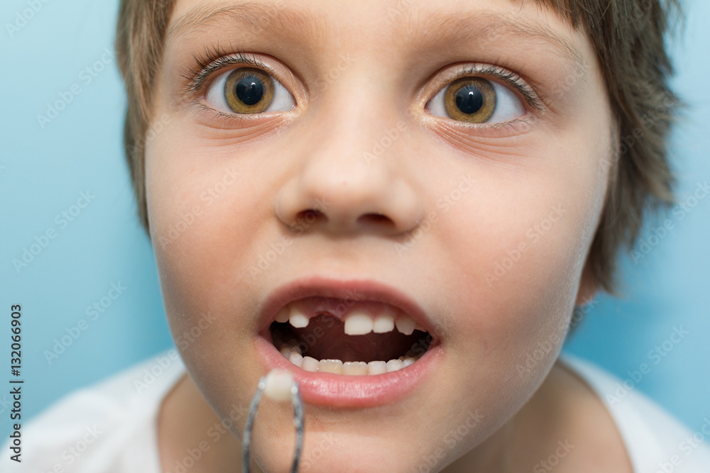Girl pulls a tooth