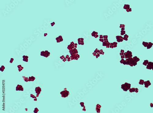 Cubic structures of Sarcina bacterium under a microscope photo