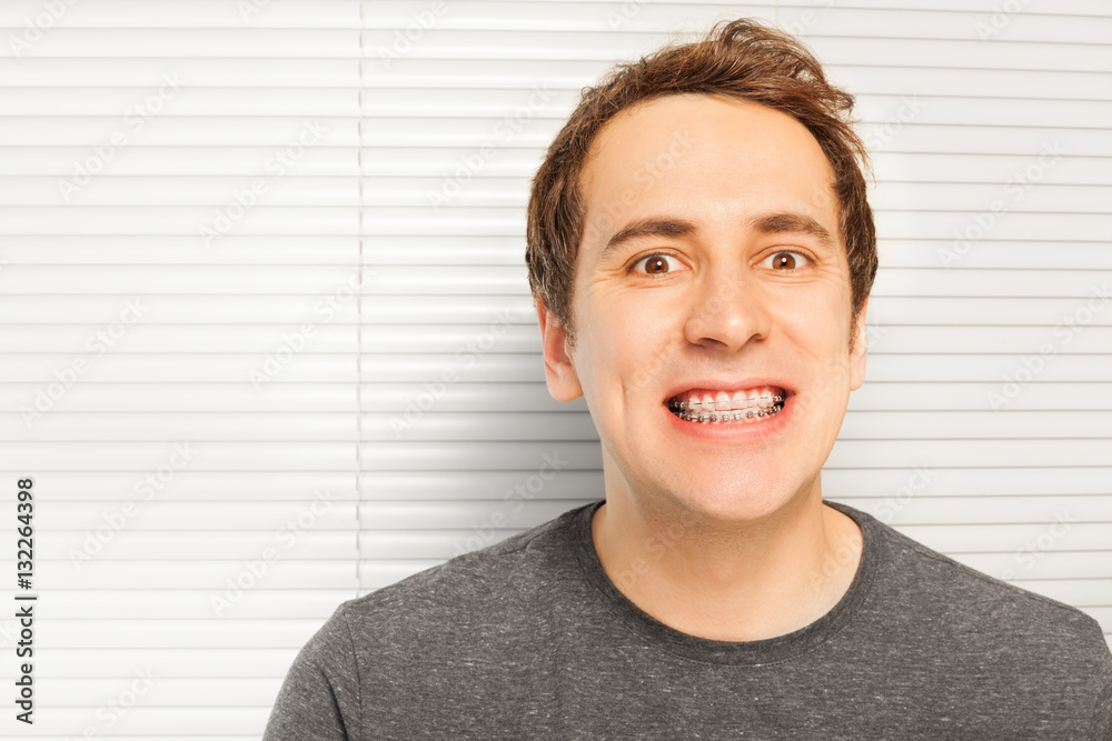 Naklejka premium Portrait of smiling young man with dental braces