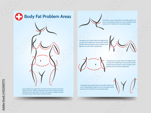 Female body fat problems areas vector illustration. Medicinal brochure flyer template design