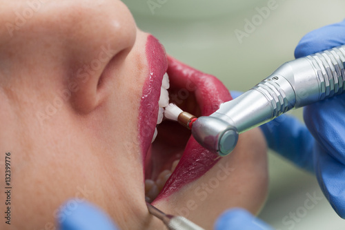 Dentysta leczy pacjentkę