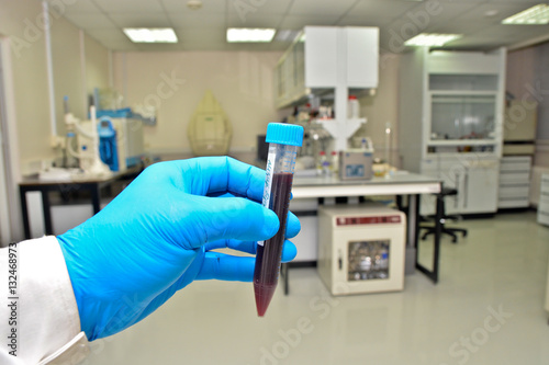 Laboratory examination of the blood.