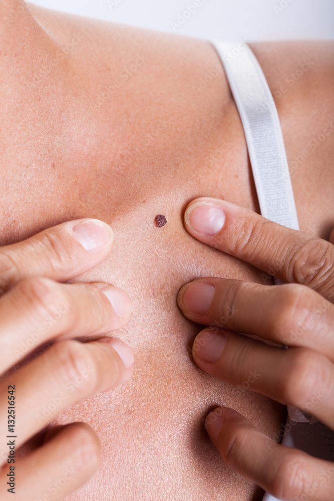 femme examinant un grain de beauté sur la peau femme examinant un grain de beauté sur la peau