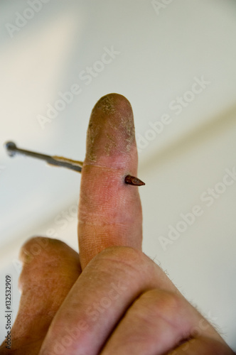 nail gun injury. Finger with nail through it