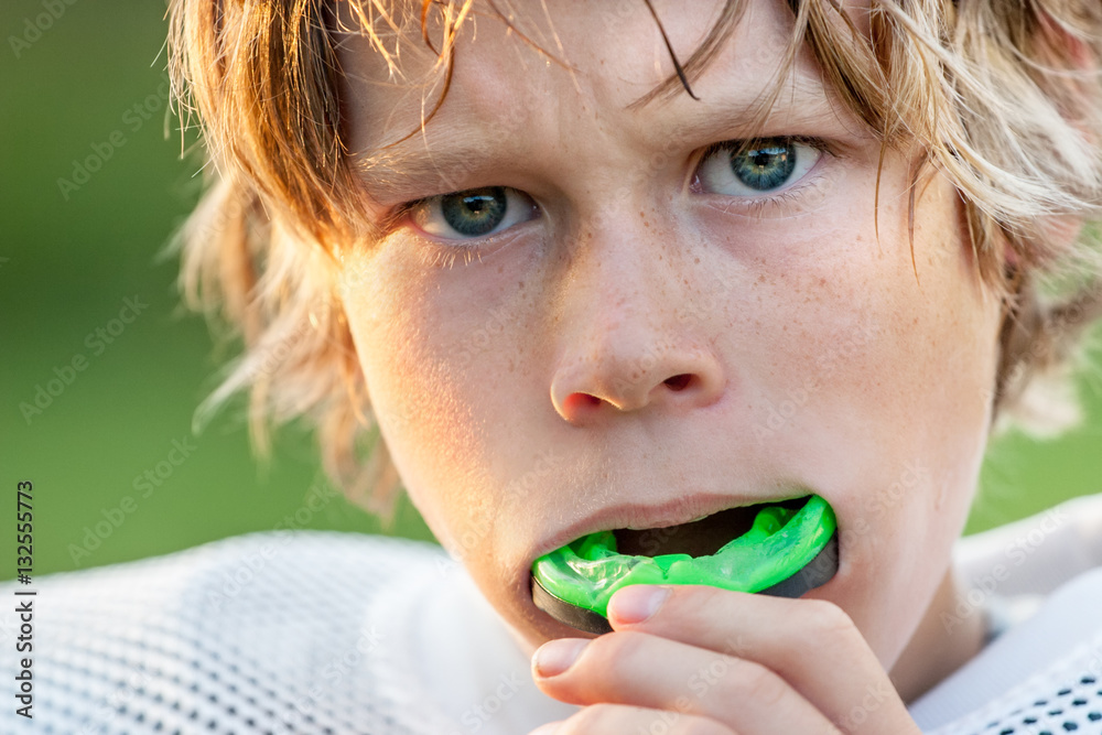 Boy putting in his mouth guard - obrazy, fototapety, plakaty 