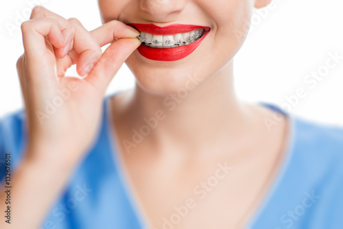 Close up view on woman s smile with tooth braces on the white background