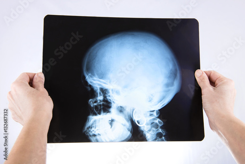 X rays of head