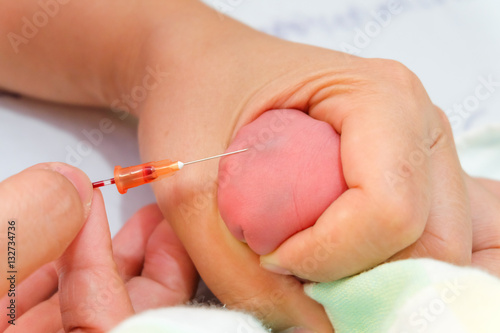 Midwife take blood sample from a newborn during metabolic screening.