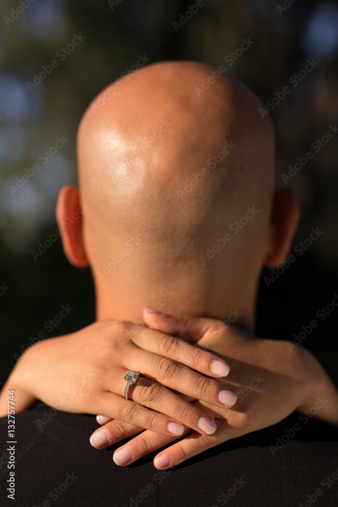 bold head with woman's hands around his neck