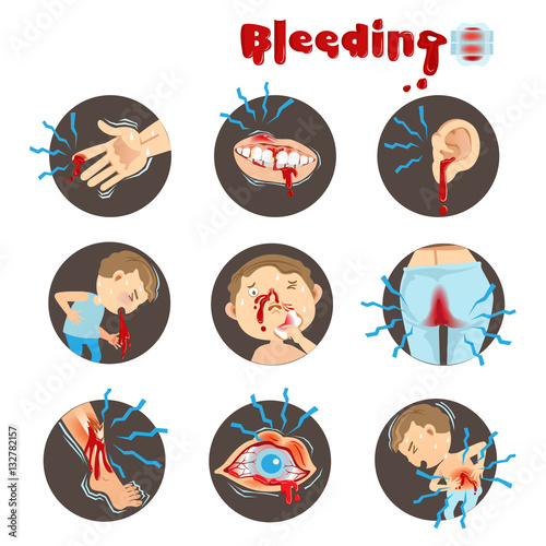 Cartoon Bleeding in a circle on a white background. Vector illustration.