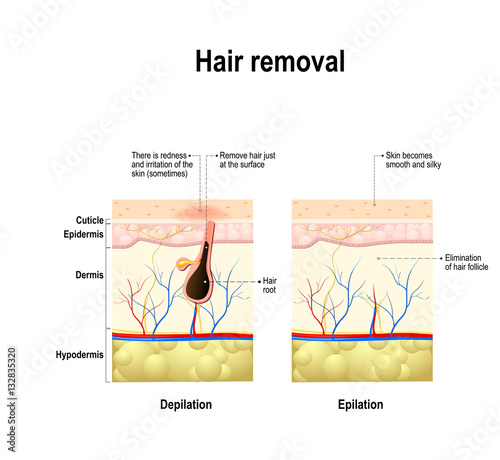 epilation and depilation difference