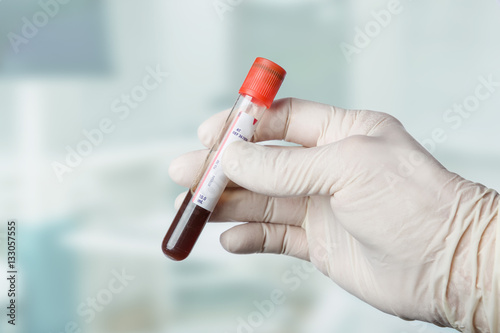 Hand mit Handschuh hält eine Blutprobe mit Labor unscharf im Hintergrund