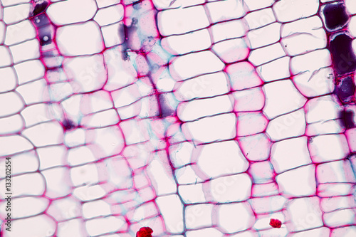 Tableau sur toile Background of Abscission layer cell under the microscope.
