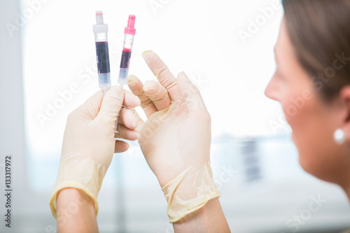 Doctor checking blood samples