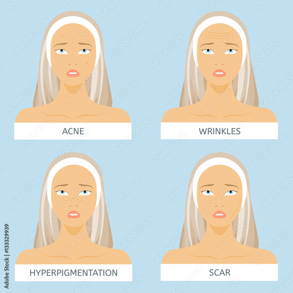 Skin problems: acne, wrinkles, hyper pigmentation, scars Skin problems: acne, wrinkles, hyper pigmentation, scars